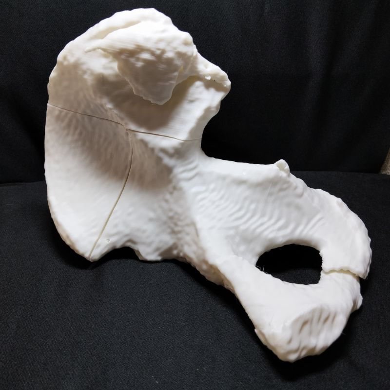 Hemipelvis armable